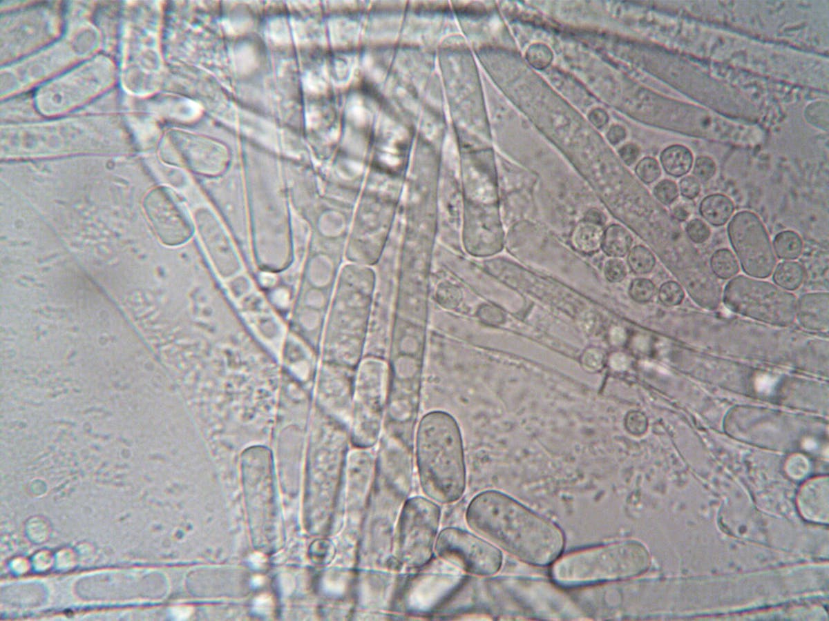 Close-up image of fungal hyphae under microscope showcasing biological structures